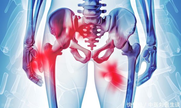 赚配网 髋关节疼痛一年内反复？医生提醒：这5种情况别拖，越拖越难受